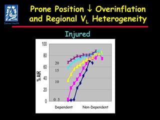 Prone Position    Overinflation and Regional V L  Heterogeneity Injured 0 5 10 15 Dependent Non-Dependent 0 5 10 15 20 Denver Health 