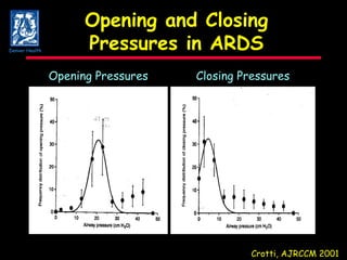 Opening and Closing Pressures in ARDS Crotti, AJRCCM 2001 Opening Pressures Closing Pressures Denver Health 