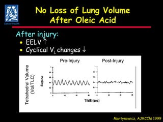 No Loss of Lung Volume After Oleic Acid After injury:  EELV    Cyclical V L  changes   Martynowicz, AJRCCM 1999 Denver Health Pre-Injury Post-Injury Tetrahedral Volume  (Vol/TLC) 