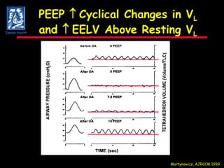 PEEP     Cyclical Changes in V L and     EELV Above Resting V L Martynowicz, AJRCCM 1999 Denver Health 