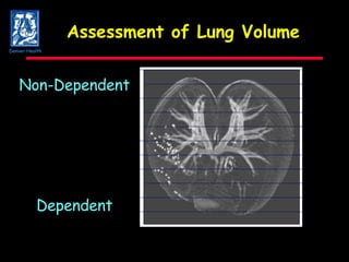 Assessment of Lung Volume Non-Dependent Dependent Denver Health 