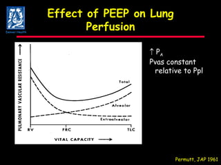 Effect of PEEP on Lung Perfusion Permutt, JAP 1961 P A Pvas constant relative to Ppl Denver Health 