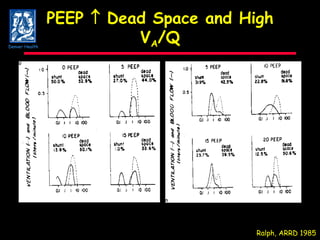PEEP    Dead Space and High V A /Q Ralph, ARRD 1985 Denver Health 