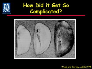 How Did it Get So Complicated? Webb and Tierney, ARRD 1974 Denver Health 