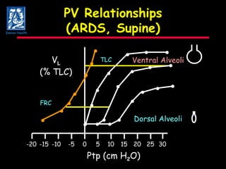 PV Relationships (ARDS, Supine) 5 10 15 20 25 V L (% TLC) Ptp (cm H 2 O) 0 -5 -10 -15 -20 30 FRC TLC               Denver Health Ventral Alveoli        Dorsal Alveoli       