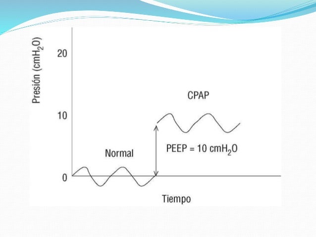 cpap peep setting cpap peep setting