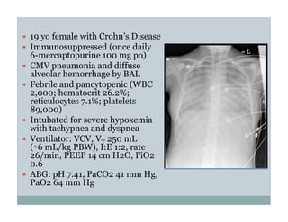 PEEP:Bring the Evidence to the Bedside