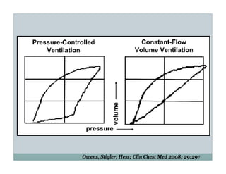 PEEP:Bring the Evidence to the Bedside