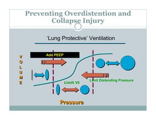 PEEP:Bring the Evidence to the Bedside