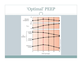 PEEP:Bring the Evidence to the Bedside