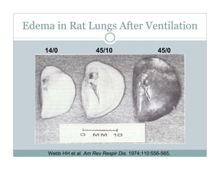 PEEP:Bring the Evidence to the Bedside