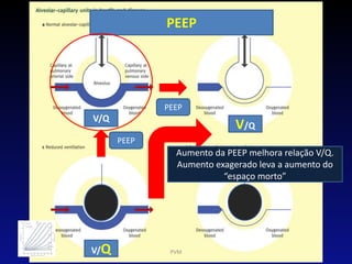 PEEP
PEEP
V/Q
V/Q
V/Q
PEEP
PVM
Aumento da PEEP melhora relação V/Q.
Aumento exagerado leva a aumento do
“espaço morto”
 