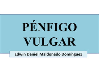 PÉNFIGO
VULGAR
Edwin Daniel Maldonado Domínguez
 