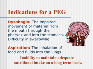 The Management of an Individual with a Percutaneous Endoscopic ...