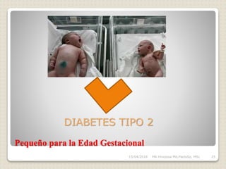 Pequeño para la Edad Gestacional
15/04/2018 MA Hinojosa Md,PædsSp, MSc 25
DIABETES TIPO 2
 