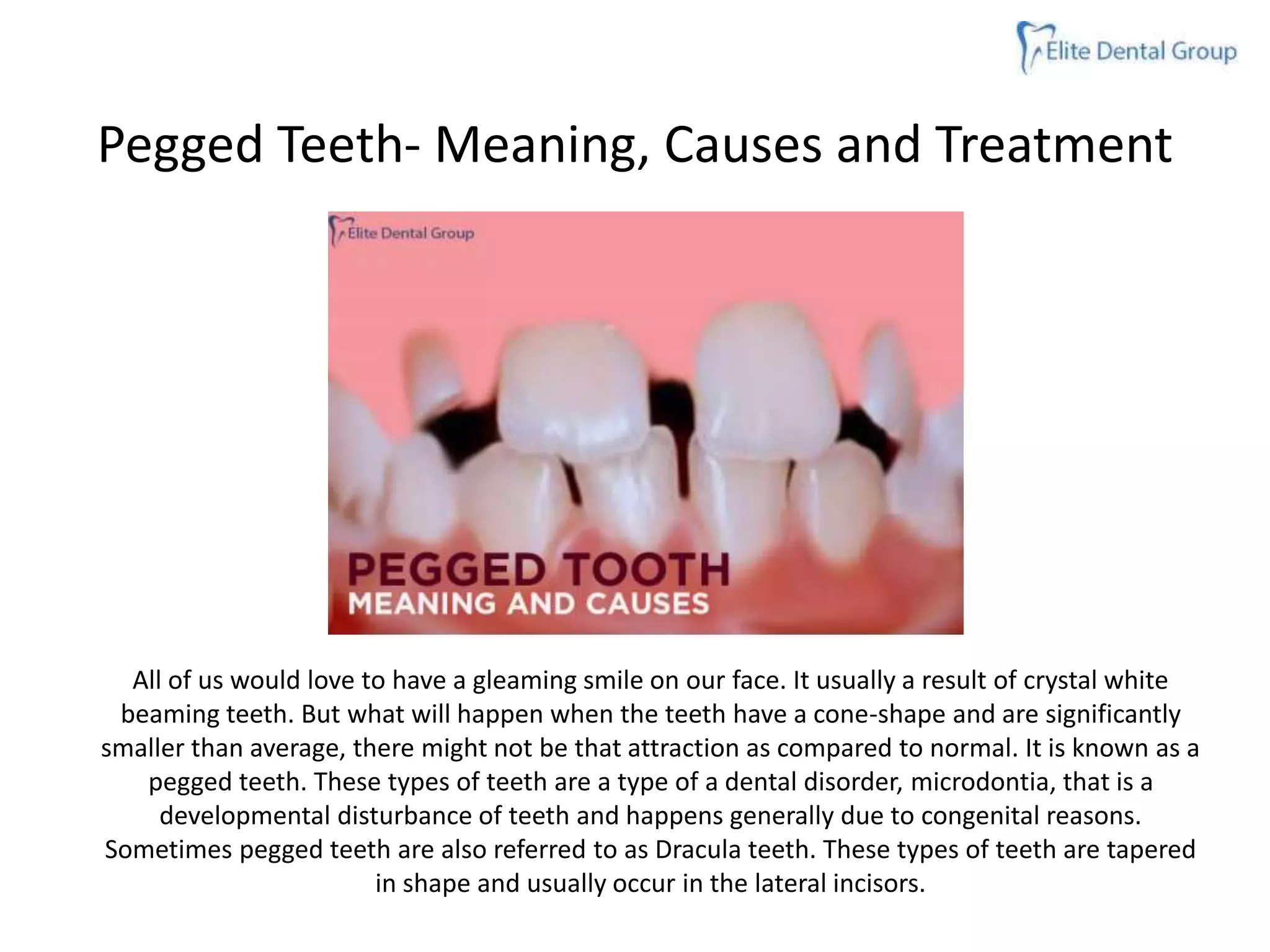 PEGGED TEETH MEANING, CAUSES AND TREATMENT PPT