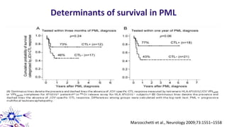 Determinants of survival in PML
Marzocchetti et al., Neurology 2009;73:1551–1558
 
