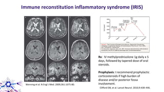 Wenning et al. N Engl J Med. 2009;361:1075-80.
Immune reconstitution inflammatory syndrome (IRIS)
Rx: IV methylprednisolone 1g daily x 5
days, followed by tapered dose of oral
steroids.
Prophylaxis: I recommend prophylactic
corticosteroids if high burden of
disease and/or posterior fossa
involvement.
Clifford DB, et al. Lancet Neurol. 2010;9:438–446.
 