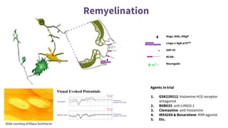 Remyelination
Nogo, MAG, OMgP
Lingo-1-NgR-p75NTR
GAP-43
NCAM
Neuregulin
Slide courtesy of Klaus Schmierer.
Agents in trial
1. GSK239512: histamine H(3) receptor
antagonist
2. BIIB033: anti-LINGO-1
3. Clemastine: anti-histamine
4. IRX4204 & Bexarotene: RXR-agonist
5. Etc.
 