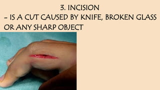 Dicing Injuries PEH 4 First Aid & Medicine Life Skills.pptx