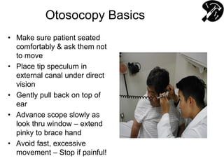 Otosocopy Basics
• Make sure patient seated
comfortably & ask them not
to move
• Place tip speculum in
external canal under direct
vision
• Gently pull back on top of
ear
• Advance scope slowly as
look thru window – extend
pinky to brace hand
• Avoid fast, excessive
movement – Stop if painful!
 