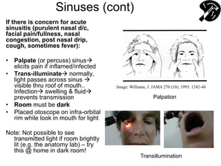 Sinuses (cont)
If there is concern for acute
sinusitis (purulent nasal d/c,
facial pain/fullness, nasal
congestion, post nasal drip,
cough, sometimes fever):
• Palpate (or percuss) sinus
elicits pain if inflamed/infected
• Trans-illuminate normally,
light passes across sinus 
visible thru roof of mouth..
Infection swelling & fluid
prevents transmission
• Room must be dark
• Placed otoscope on infra-orbital
rim while look in mouth for light
Note: Not possible to see
transmitted light if room brightly
lit (e.g. the anatomy lab) – try
this @ home in dark room!
Transillumination
Palpation
Image: Williams, J. JAMA 270 (10); 1993: 1242-46
 