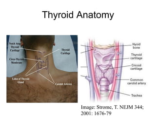 Thyroid Anatomy
Image: Strome, T. NEJM 344;
2001: 1676-79
 