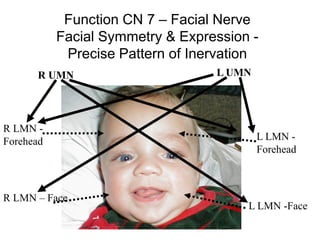 Function CN 7 – Facial Nerve
Facial Symmetry & Expression -
Precise Pattern of Inervation
L UMNR UMN
R LMN -
Forehead
R LMN – Face
L LMN -
Forehead
L LMN -Face
 