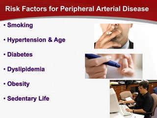Risk Factors for Peripheral Arterial Disease
 