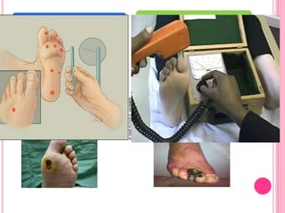  Signs-
loss of vibratory and position sense
loss of deep tendon reflexes
trophic ulceration
foot drop
muscle atrophy
excessive callus formation
 Semmes-Weinstein filament
 Biothesiometer
 Pulsation of dorsalis pedis artery and
posterior tibial artery
 Bruit at iliac or femoral arteries
 Skin atrophy
 Loss of pedal hair growth
 Toe cyanosis
 Ulceration or ischemic necrosis
 Pallor and rubor after 1-2 minutes of
elevation above heart level
 History of claudication
ASSESSMENT OF
NEUROPATHY
ASSESSMENT OF PERIPHERAL
ARTERIAL DISEASE
 