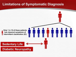 Limitations of Symptomatic Diagnosis
Only 1 in 10 of these patients
has classical symptoms of
intermittent claudication (IC)
Diabetic Neuropathy
Sedentary Life
 