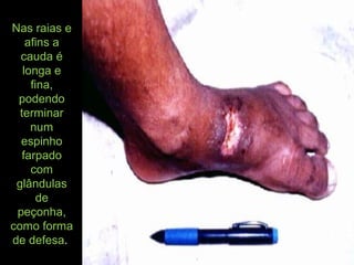 Nas raias e
afins a
cauda é
longa e
fina,
podendo
terminar
num
espinho
farpado
com
glândulas
de
peçonha,
como forma
de defesa.
 