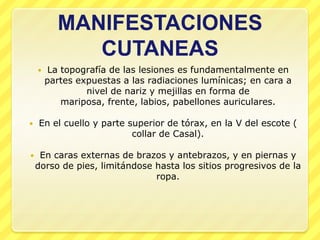 MANIFESTACIONES
             CUTANEAS
        La topografía de las lesiones es fundamentalmente en
        partes expuestas a las radiaciones lumínicas; en cara a
                 nivel de nariz y mejillas en forma de
            mariposa, frente, labios, pabellones auriculares.

   En el cuello y parte superior de tórax, en la V del escote (
                          collar de Casal).

    En caras externas de brazos y antebrazos, y en piernas y
    dorso de pies, limitándose hasta los sitios progresivos de la
                               ropa.
 