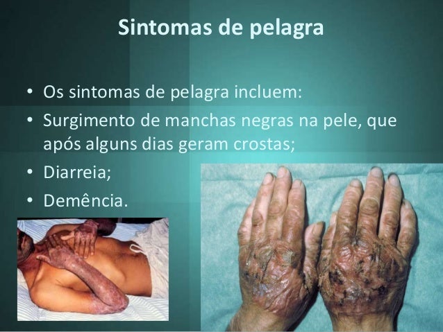 Embalagens de bebida paradas, contraceptivo no meio