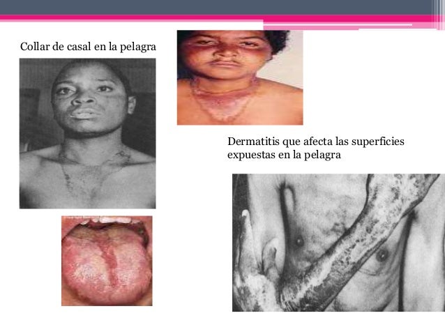 Contra las manchas de pigmento después del parto