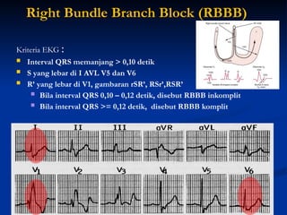 Rsr Rbbbb Pelatihan EKG yang terstruktur untuk perawat | PPTX