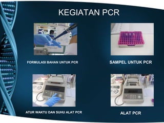 KEGIATAN PCR




FORMULASI BAHAN UNTUK PCR      SAMPEL UNTUK PCR




ATUR WAKTU DAN SUHU ALAT PCR       ALAT PCR
 