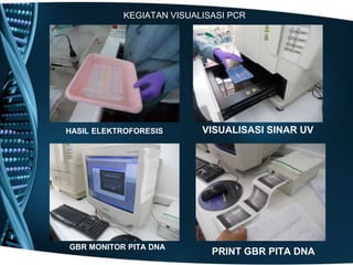 KEGIATAN VISUALISASI PCR




HASIL ELEKTROFORESIS      VISUALISASI SINAR UV




GBR MONITOR PITA DNA
                            PRINT GBR PITA DNA
 