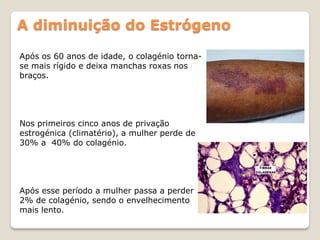 A diminuição do Estrógeno

Após os 60 anos de idade, o colagénio torna-
se mais rígido e deixa manchas roxas nos
braços.




Nos primeiros cinco anos de privação
estrogénica (climatério), a mulher perde de
30% a 40% do colagénio.




Após esse período a mulher passa a perder
2% de colagénio, sendo o envelhecimento
mais lento.
 