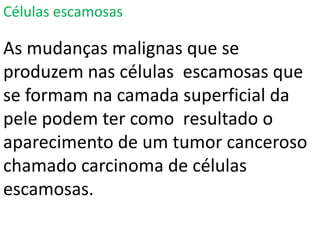 Células escamosas

As mudanças malignas que se
produzem nas células escamosas que
se formam na camada superficial da
pele podem ter como resultado o
aparecimento de um tumor canceroso
chamado carcinoma de células
escamosas.
 