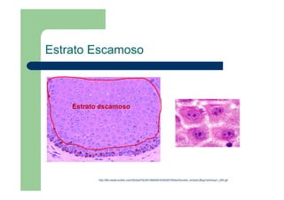 Estrato Escamoso
http://68.media.tumblr.com/29c0a375cd5109e6561632b5d730bbc0/tumblr_mr2q3nJBsg1s24chqo1_500.gif
Estrato escamoso
 