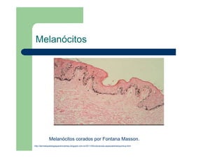 Melanócitos
http://dermatopatologiaparainiciantes.blogspot.com.br/2011/05/coloracoes-especiaishistoquimica.html
Melanócitos corados por Fontana Masson.
 