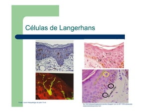Células de Langerhans
Fonte: Lever:Histopatolgia da pele 10 ed
ttp://dermatopatologiaparainiciantes.blogspot.com.br/2011/05/coloracoes-
especiaishistoquimica.html
 