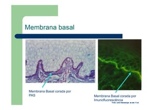 Membrana basal
Membrana Basal corada por
PAS Membrana Basal corada por
Imunofluorescência
 
