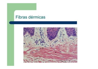 Fibras dérmicas
 