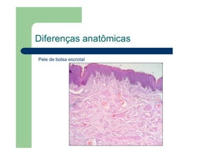 Diferenças anatômicas
Pele de bolsa escrotal
 