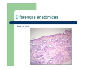 Diferenças anatômicas
Pele da face
 