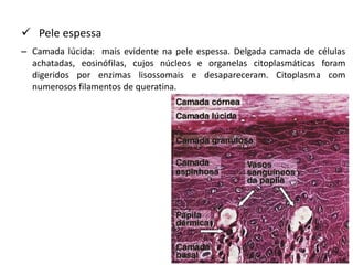  Pele espessa
– Camada lúcida: mais evidente na pele espessa. Delgada camada de células
achatadas, eosinófilas, cujos núcleos e organelas citoplasmáticas foram
digeridos por enzimas lisossomais e desapareceram. Citoplasma com
numerosos filamentos de queratina.
 