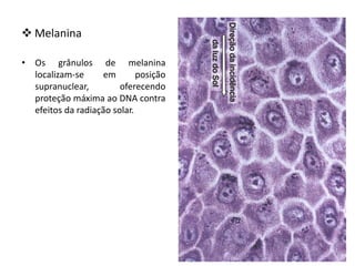  Melanina
• Os grânulos de melanina
localizam-se em posição
supranuclear, oferecendo
proteção máxima ao DNA contra
efeitos da radiação solar.
 