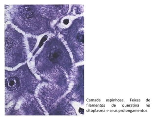 Camada espinhosa. Feixes de
filamentos de queratina no
citoplasma e seus prolongamentos
 